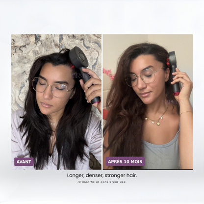 en-us| before after
