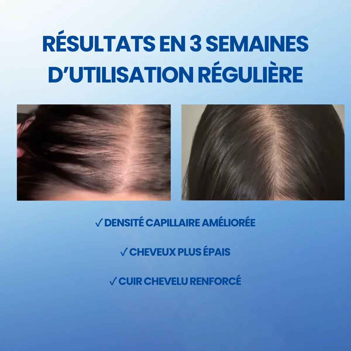 Sérum Capillaire Coréen - Pousse & Anti-Chute Hairmony