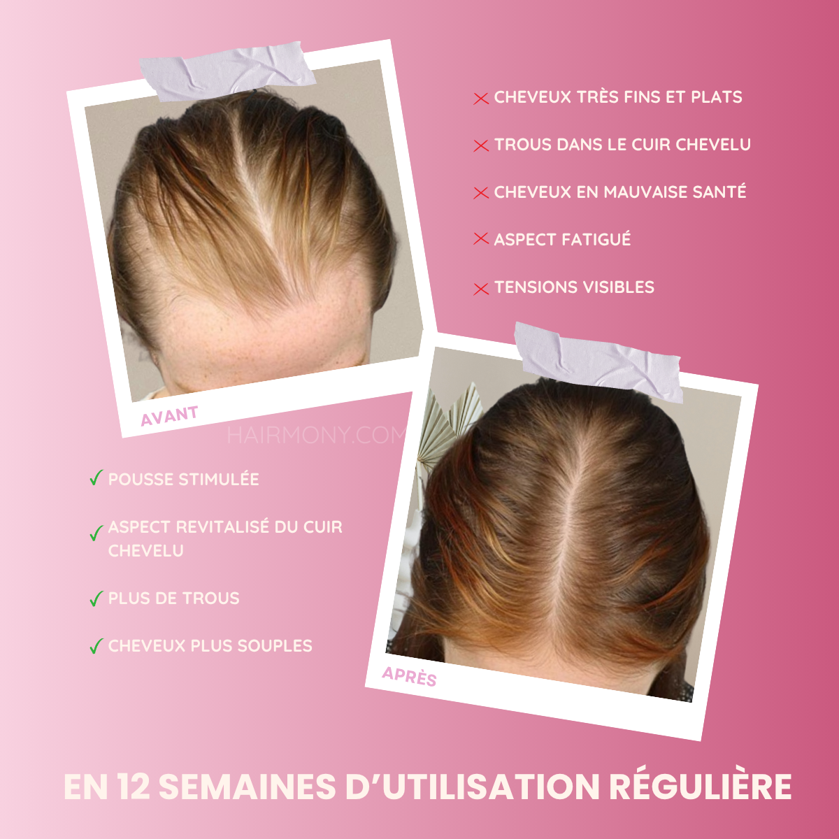 Brosse massante Lumeila™ Hairmony