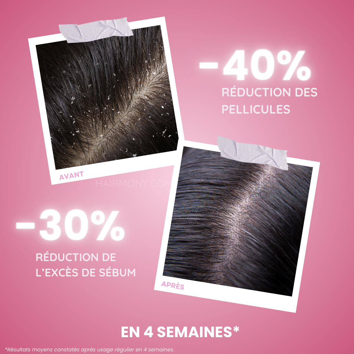 Brosse massante Lumeila™ Hairmony